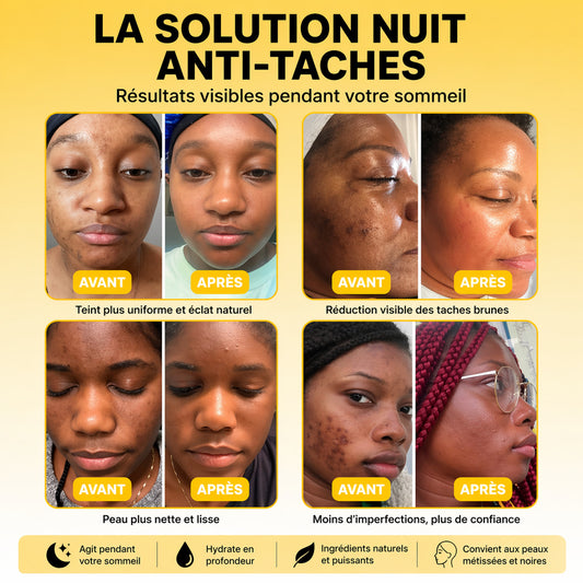 Masque Nuit Éclat – Teint Propre & Lumineux